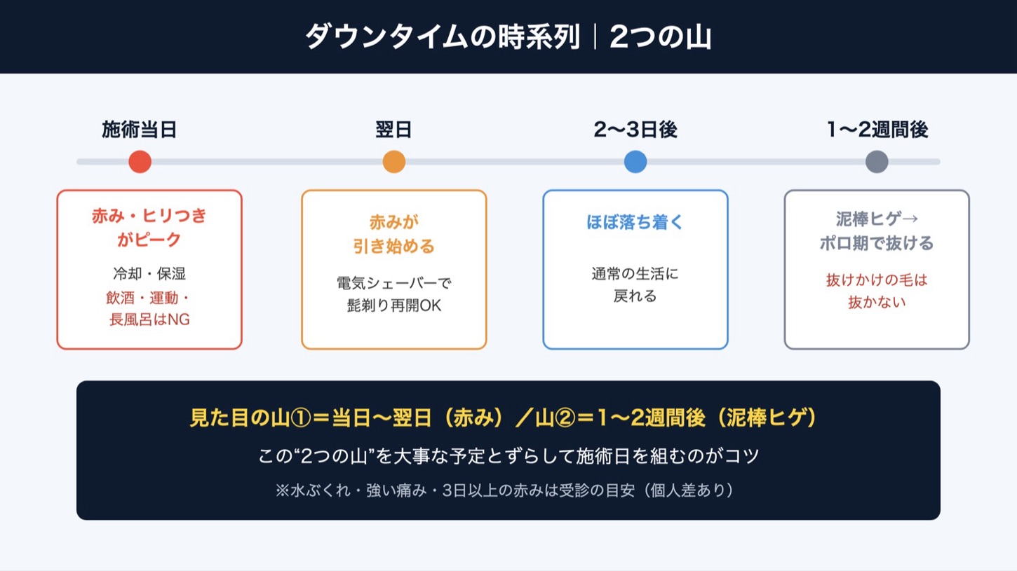 ヒゲ脱毛ダウンタイムの時系列（図解）