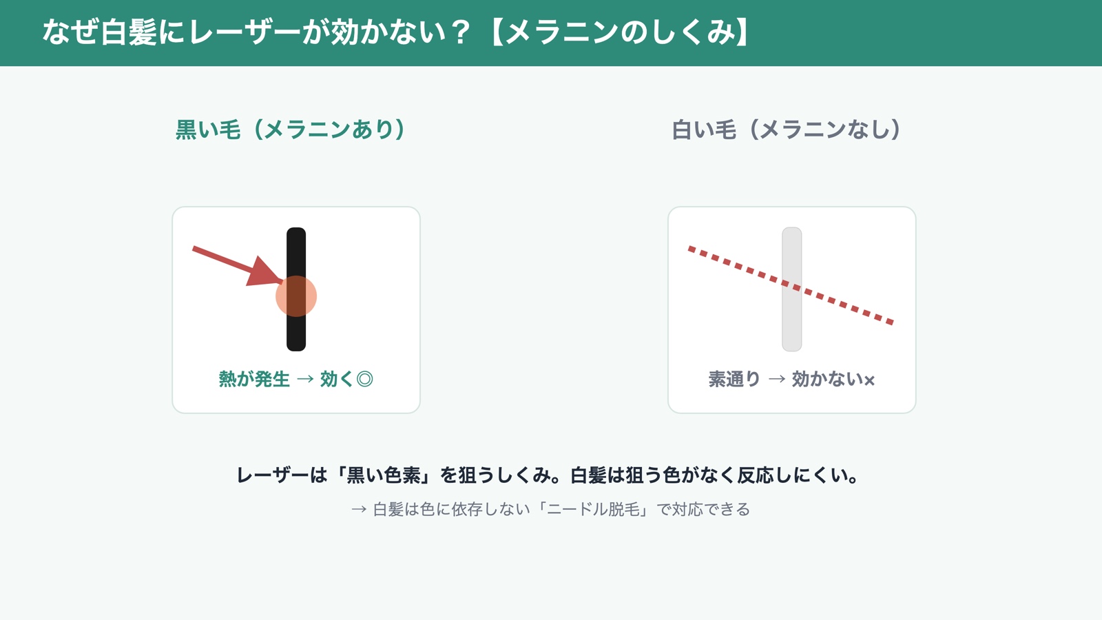 なぜ白髪にレーザーが効かない?メラニンのしくみ(図解)